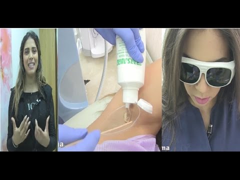 طرق سهلة لإزالة الشعر بشكل نهائي