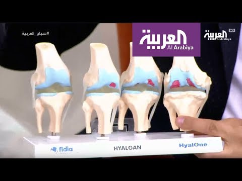 شاهد عرض حي وسريع لمشكلة خشونة الركبة