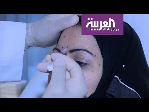 شاهد حقنة من الفيلر تسبب العمى